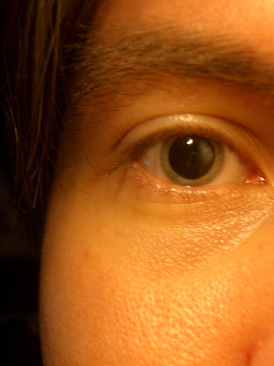 dilation